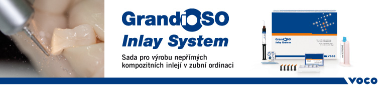 Voco GrandioSo Inlay System