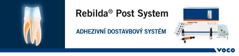 Voco Rebilda Post System